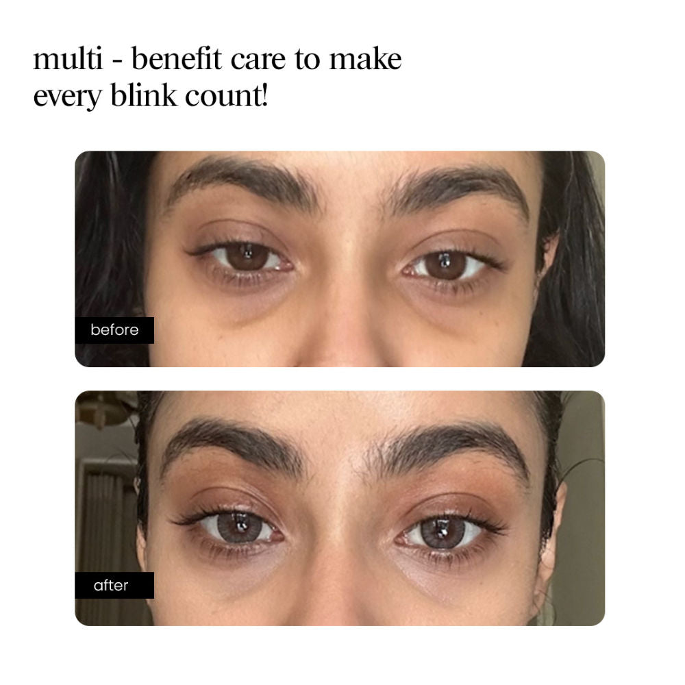 Eye Serum – Peptide, Caffeine, HA + 15 Actives for Dark Circles, Puffiness, Wrinkles, Fine Lines