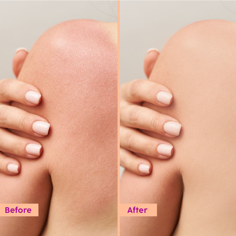 Peaches & Lemon Detan Body Lotion with SPF 30
