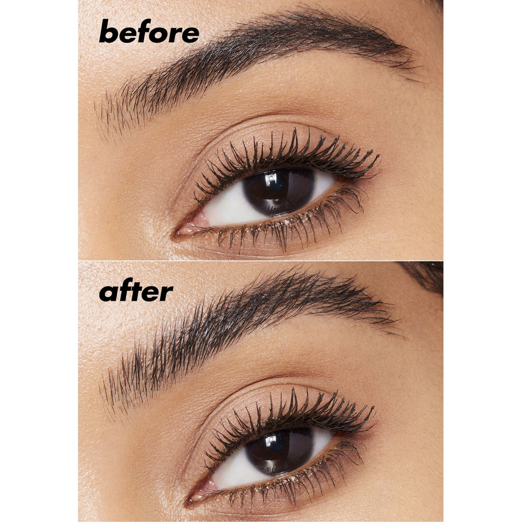 Brow Lift Clear