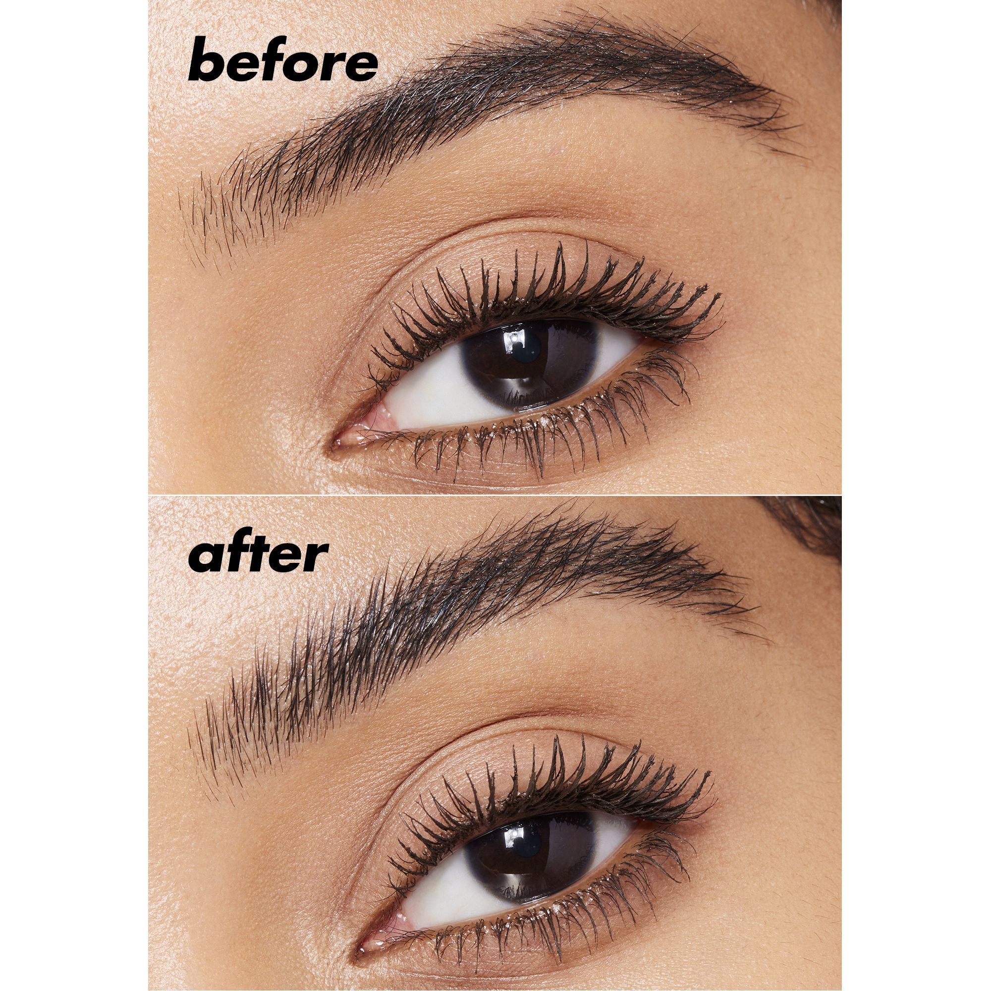 Brow Lift Clear