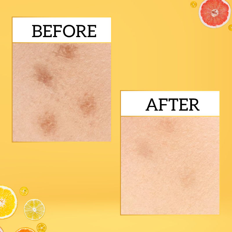 Vitamin-C Serum with Hyaluronic Acid, Amla & Turmeric, Lightweight Formula for Glowing Skin