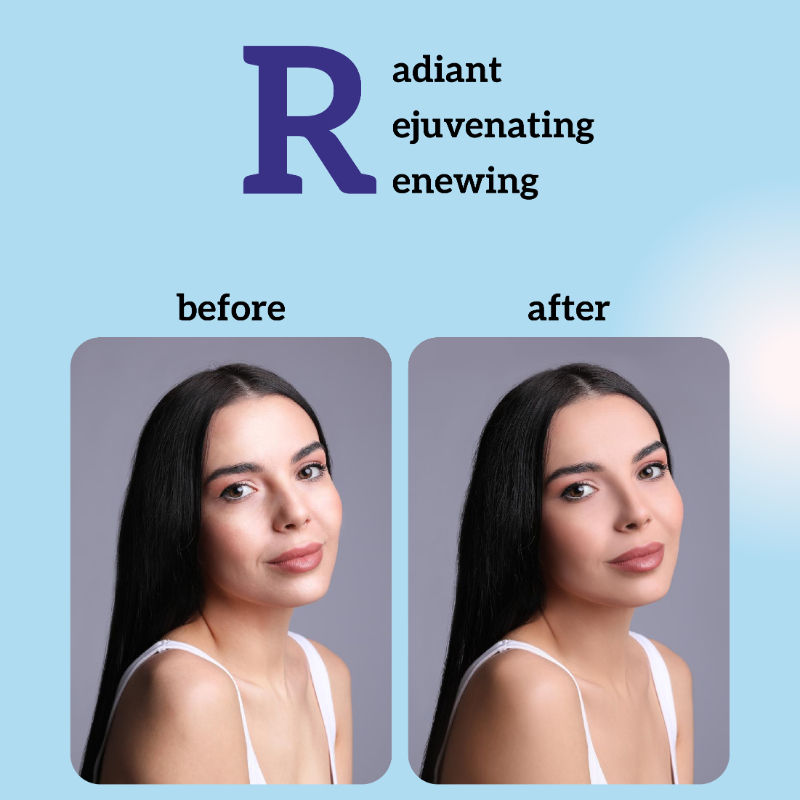Collagen Face Serum with Peptides, Anti-Aging, Boosts Elasticity, Firms Skin & Restores Glow