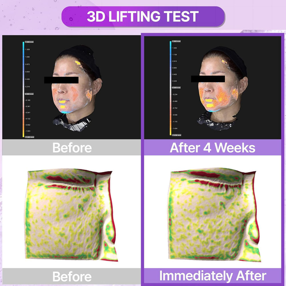 Probioderm 3D Lifting Essential Toner - Improves Skin Texture & Elasticity
