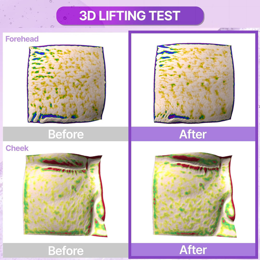 Probioderm 3D Lifting Emulsion - Smoothes Fine Lines & Boosts Firmness