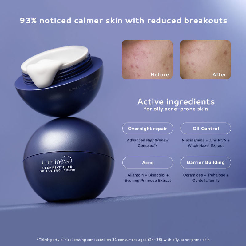 Lightweight Moisturizer for Oily & Acne Prone Skin with Niacinamide for Hydrating Skin