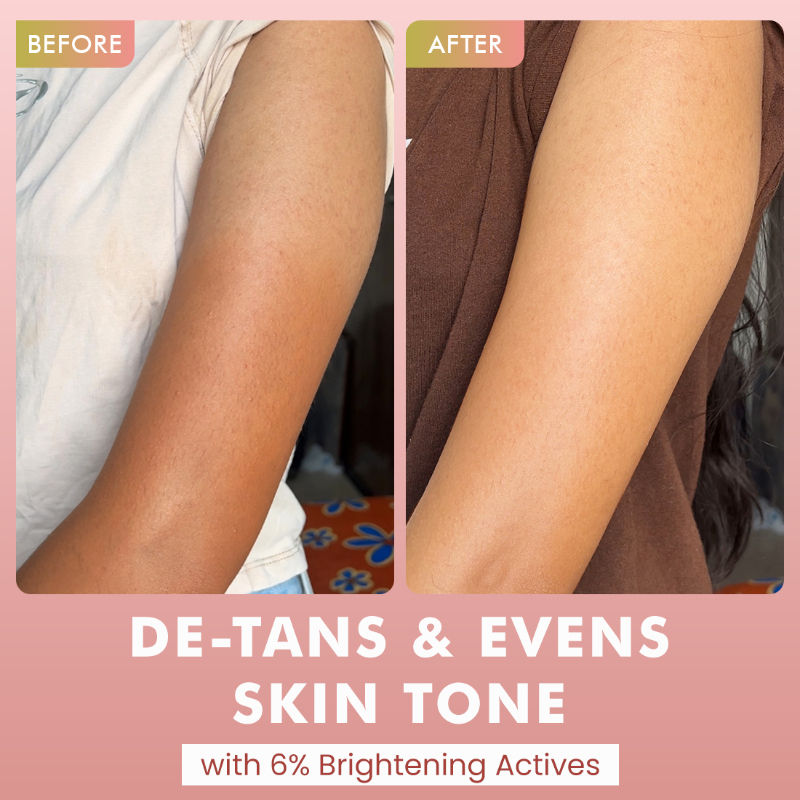 1% Glycolic Acid Detan Body Wash, 5% Niacinamide-Kojic Acid Reduces Dark Spots & Brightens