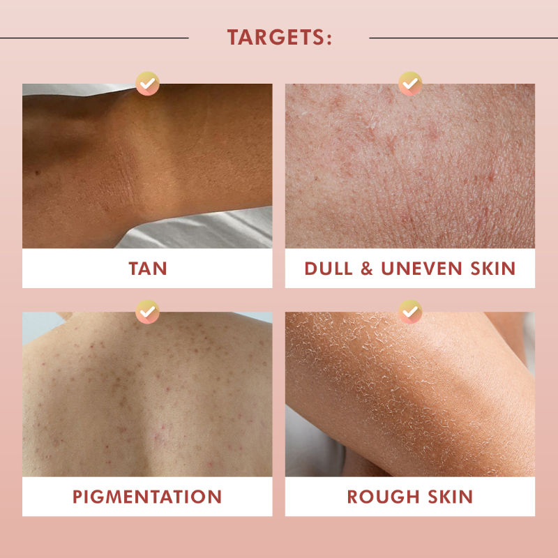 1% Glycolic Acid Detan Body Wash, 5% Niacinamide-Kojic Acid Reduces Dark Spots & Brightens