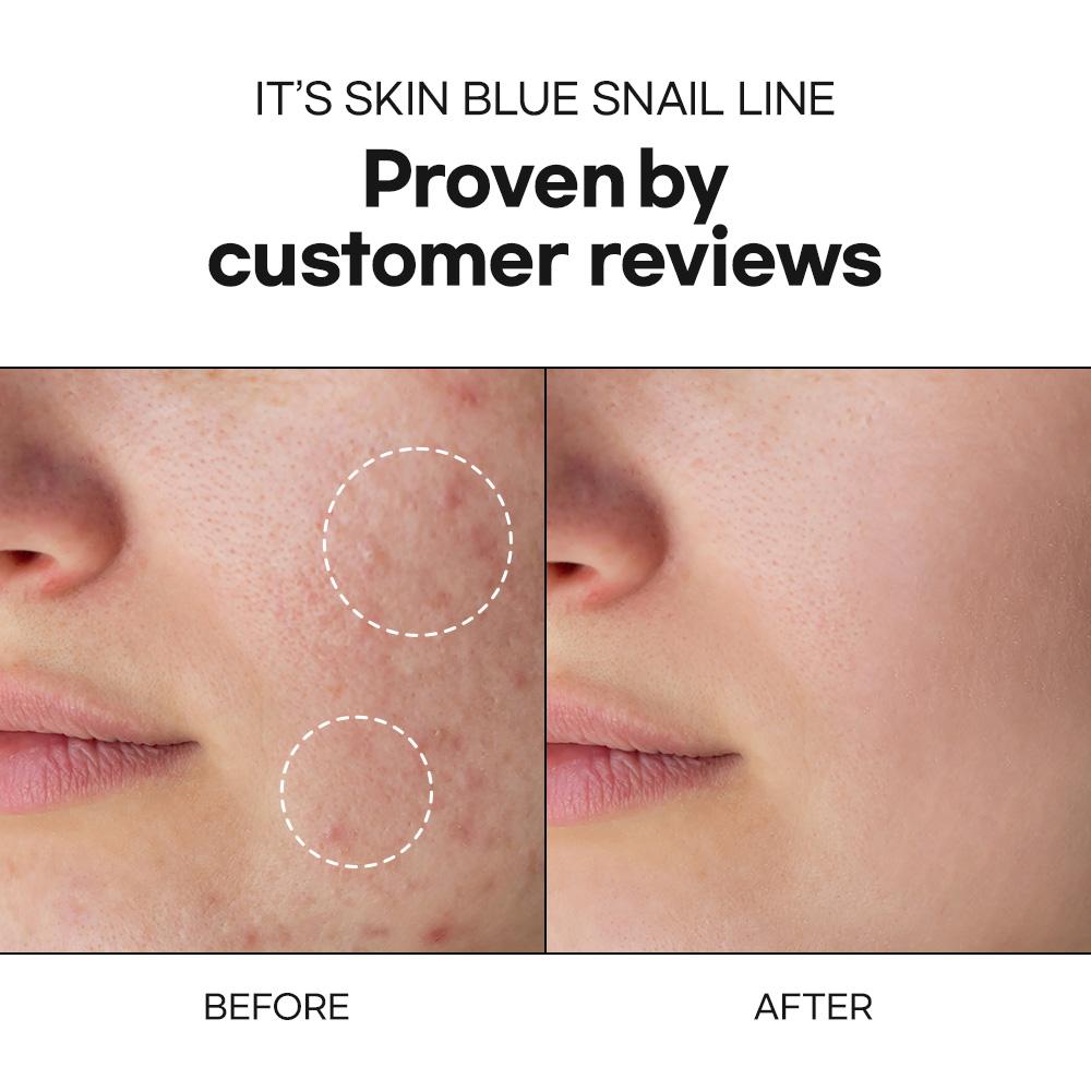 Blue Snail Moisturizer
