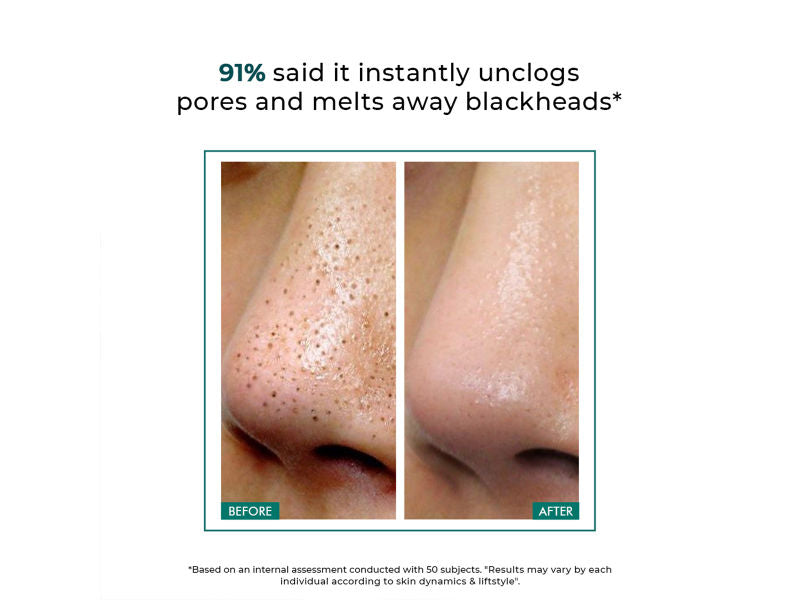 Blackhead Melting Water Mini