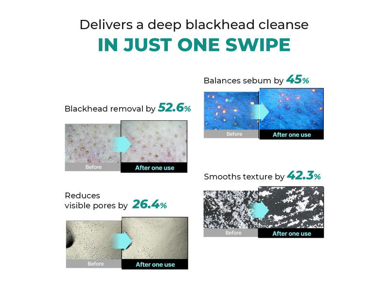 Blackhead Melting Water Mini
