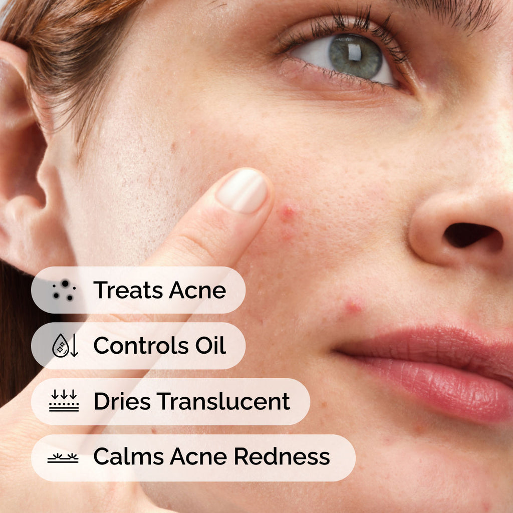 Sulfur 10% Powder-to-Cream Concentrate - Acne Spot Correction for Sensitive Skin